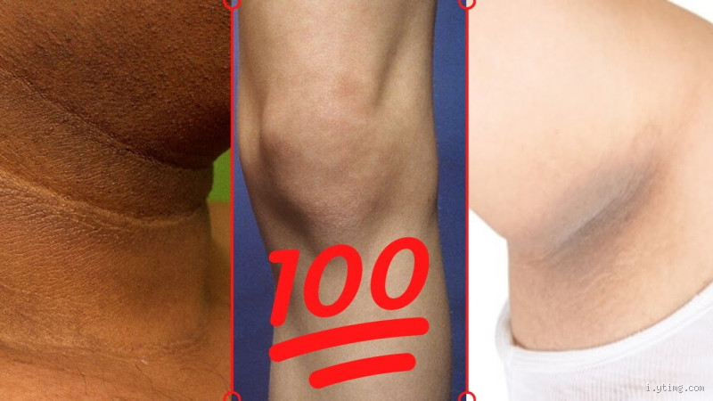 كيفية تفتيح منطقة ما بين الفخذين؟ نصائح فعالة وآمنة