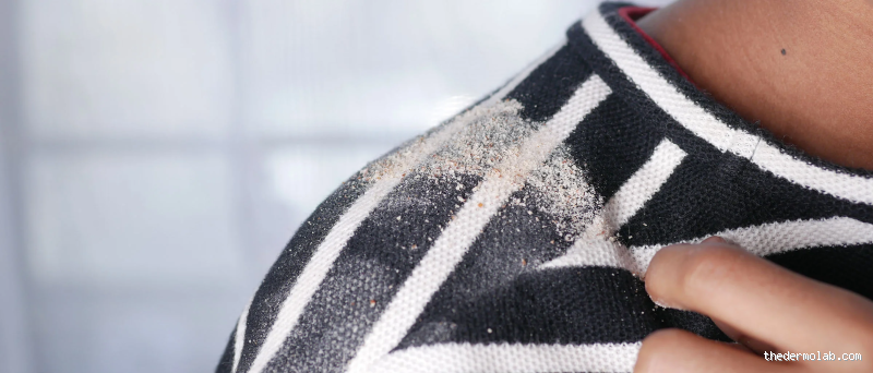 هل كشف الشعر من التبرج؟ اكتشف الحقيقة المدهشة!