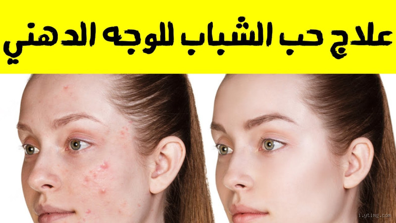 هل غسل الوجه بالماء يزيل حب الشباب؟ اكتشف الحقيقة