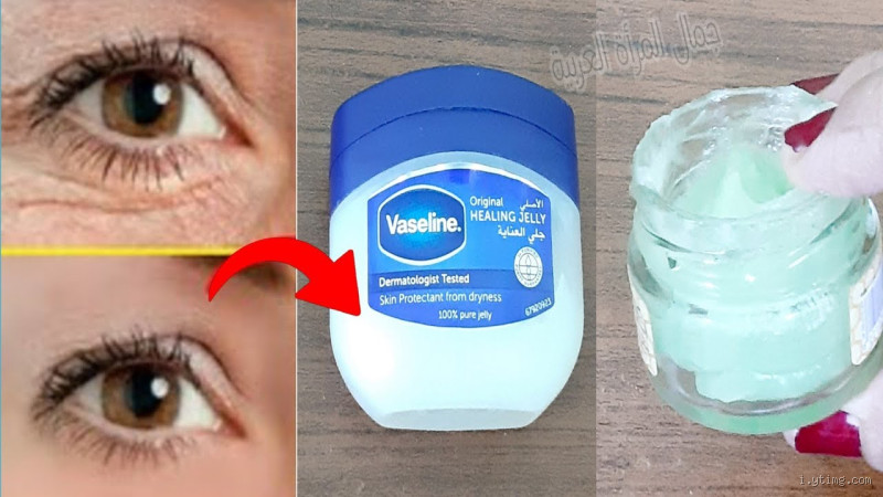 هل الفازلين يزيل تجاعيد تحت العين؟
