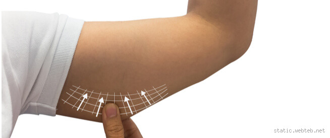 هل ممكن الجسم يشد نفسه بنفسه؟ الحقيقة الكاملة عن شد الترهلات طبيعيًا