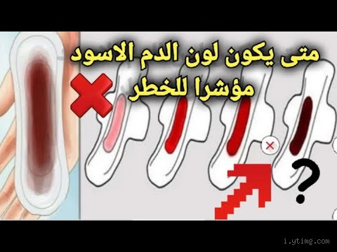 هل نزول لون اسود بعد الاغتسال من دم الحيض يفسد الصيام؟