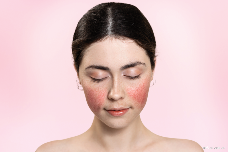 هل تختفي القطعة الوردية بعد فض الغشاء؟ كل ما تحتاج معرفته