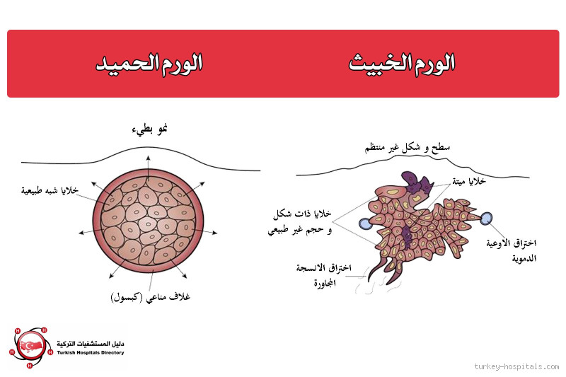 هل يوجد ورم حميد في الرئة؟ تعرف على الحقيقة المخفية