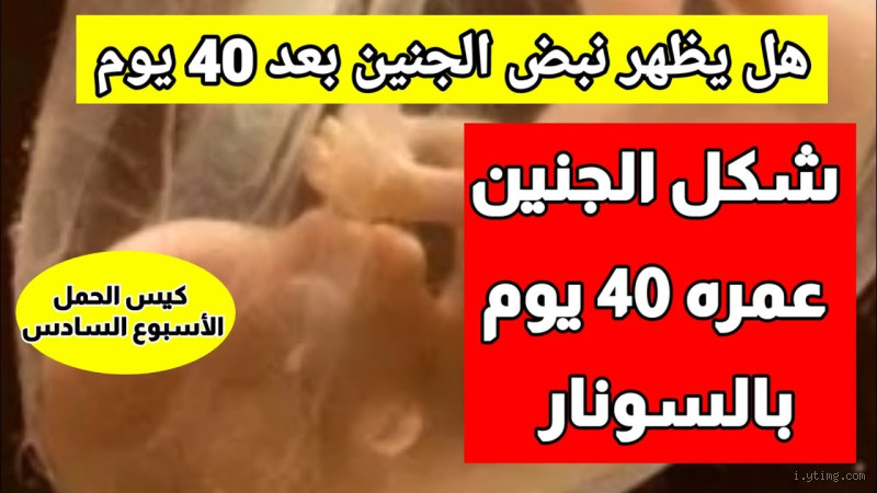هل يظهر كيس الحمل بعد 40 يوم؟ إجابة شاملة ومبسّطة