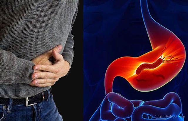 كم يوم يستمر التهاب المعدة؟