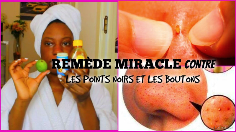 كيف انحف الوجه والرقبة؟ نصائح فعالة للحصول على مظهر مشدود