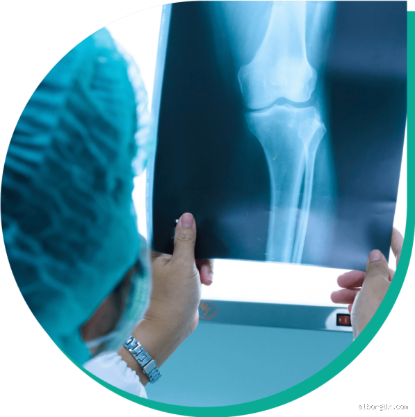 كيف اعرف ان عندي سرطان العظام؟ علامات وأعراض يجب الانتباه لها