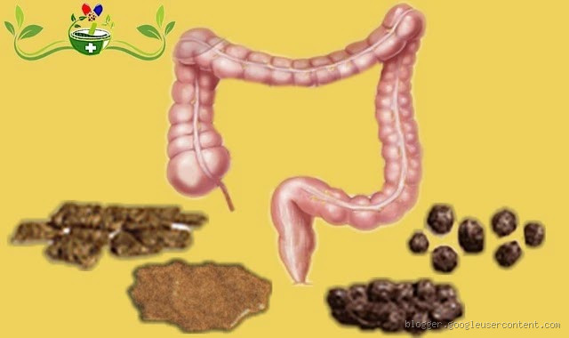 كيف يكون براز القولون العصبي؟