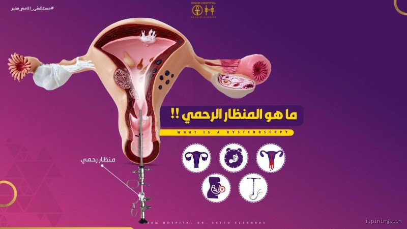 كيف يكون ألم الرحم؟ كل ما يجب أن تعرفه عن هذا الألم المزعج