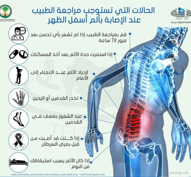 ما هو ألم العصب؟