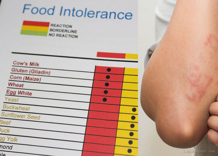 ما هو اسم تحليل حساسية الجلوتين؟ تعرف على التفاصيل