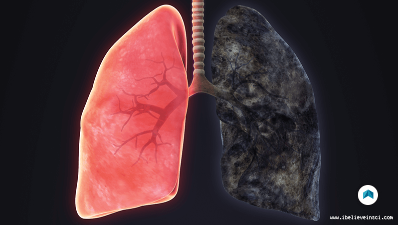 ماذا يعني وجود بقع في الرئة؟ اكتشف الأسباب والمخاطر