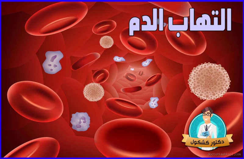 ماذا يعني وجود التهاب في تحليل الدم؟ تعرف على الأسباب والعلاج