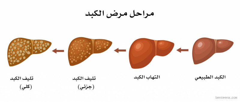 ماذا يحدث للكبد عند الخوف؟
