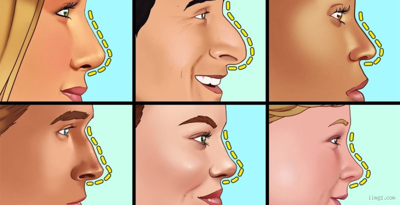 متى يتحدد شكل الأنف؟ كل ما تحتاج معرفته عن تطور الأنف